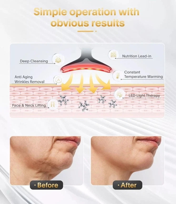 Facelifter pro